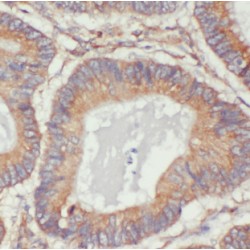 Myosin Light Chain 9, Regulatory (MYL9) Antibody