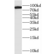 WB analysis of human heart tissue, using MYLK3 antibody (1/500 dilution).