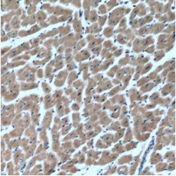 Myosin Light Chain Kinase 4 (MYLK4) Antibody