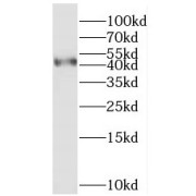 WB analysis of L02 cells, using MYLK4 antibody (1/1000 dilution).