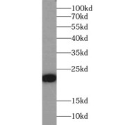 WB analysis of mouse skeletal muscle tissue, using MYLPF antibody (1/500 dilution).