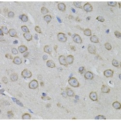 Myosin X (MYO10) Antibody