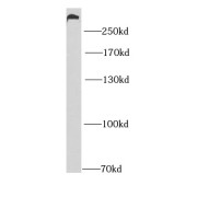 WB analysis of mouse kidney tissue, using MYO10 antibody (1/1000 dilution).