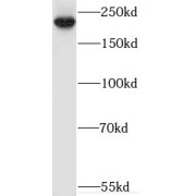 WB analysis of human brain tissue, using MYO16 antibody (1/500 dilution).