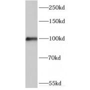 WB analysis of mouse lung tissue, using MYO1D antibody (1/200 dilution).