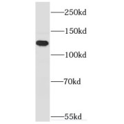 WB analysis of HeLa cells, using MYO1E antibody (1/500 dilution).