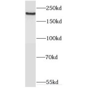 WB analysis of L02 cells, using MYO7A antibody (1/500 dilution).