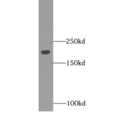 WB analysis of human skeletal muscle tissue, using Myosin 2a antibody (1/4000 dilution).