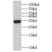 WB analysis of rat skeletal muscle tissue, using MYOZ3 antibody (1/1000 dilution).