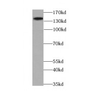 WB analysis of HeLa cells, using MYPN-Specific antibody (1/300 dilution).