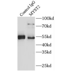 Histone Acetyltransferase KAT7 (MYST2) Antibody