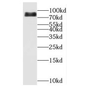 WB analysis of NIH/3T3 cells, using MYST2 antibody (1/500 dilution).