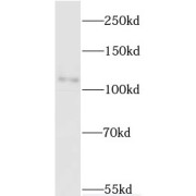 WB analysis of HepG2 cells, using MYT1L antibody (1/600 dilution).