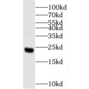 WB analysis of HEK-293 cells, using N6AMT1 antibody (1/600 dilution).