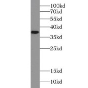 WB analysis of human brain tissue, using NAGK antibody (1/600 dilution).