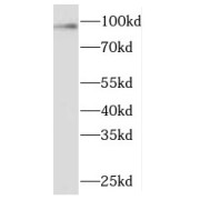 WB analysis of HeLa cells, using NARG1 antibody (1/300 dilution).