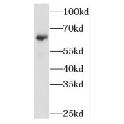 WB analysis of HepG2 cells, using NARS antibody (1/500 dilution).