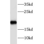 WB analysis of mouse colon tissue, using NBL1 antibody (1/100 dilution).