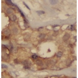 Next To BRCA1 Gene 1 Protein (NBR1) Antibody