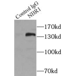 Next To BRCA1 Gene 1 Protein (NBR1) Antibody