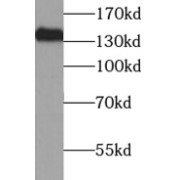 WB analysis of HeLa cells, using NBR1 antibody (1/1000 dilution).