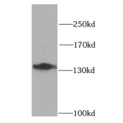 WB analysis of mouse brain tissue, using N-cadherin antibody (1/1000 dilution).