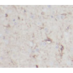 Neurocalcin-Delta (NCALD) Antibody