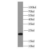 WB analysis of human brain tissue, using NCALD antibody (1/1000 dilution).