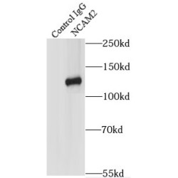 Neural Cell Adhesion Molecule 2 (NCAM2) Antibody