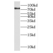 WB analysis of mouse brain tissue, using NCKIPSD antibody (1/500 dilution).