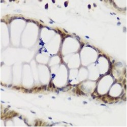 Nucleolin (NCL) Antibody