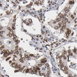 Nuclear Receptor Coactivator 3 (NCOA3) Antibody