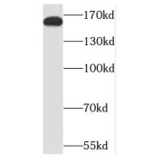 WB analysis of HeLa cells, using NCOA3 antibody (1/300 dilution).