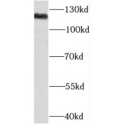 WB analysis of HepG2 cells, using NCOR1 antibody (1/300 dilution).