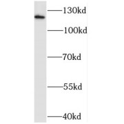 WB analysis of mouse brain tissue, using NCX1 antibody (1/1000 dilution).