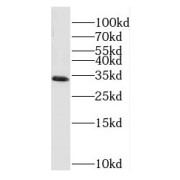 WB analysis of mouse liver tissue, using ND1 antibody (1/1000 dilution).