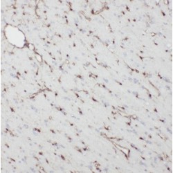 NDC80, Kinetochore Complex Component (NDC80) Antibody