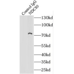 NDC80, Kinetochore Complex Component (NDC80) Antibody