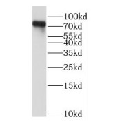 WB analysis of A2780 cells, using NDC80 antibody (1/500 dilution).