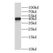 WB analysis of human brain tissue, using NDEL1 antibody (1/500 dilution).