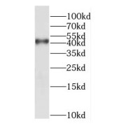 WB analysis of rat brain tissue, using NDRG2 antibody (1/1000 dilution).