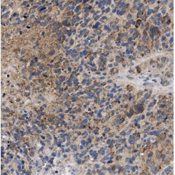 Protein NDRG4 (NDRG4) Antibody