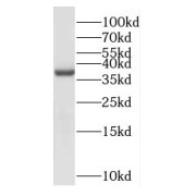 WB analysis of human brain tissue, using NDRG4 antibody (1/400 dilution).