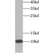 WB analysis of HeLa cells, using NDUFA4L2 antibody (1/1000 dilution).