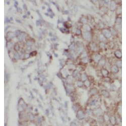 NDUFA4, Mitochondrial Complex Associated Like 2 (NDUFA4L2) Antibody