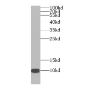 WB analysis of HeLa cells, using NDUFA4L2 antibody (1/1000 dilution).