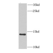 WB analysis of human heart tissue, using NDUFA6 antibody (1/1000 dilution).