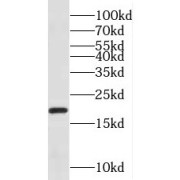 WB analysis of human heart tissue, using NDUFA8 antibody (1/500 dilution).