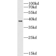 WB analysis of HT-29 cells, using NDUFA9 antibody (1/500 dilution).