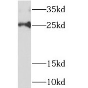 WB analysis of HepG2 cells, using NDUFAF2 antibody (1/800 dilution).